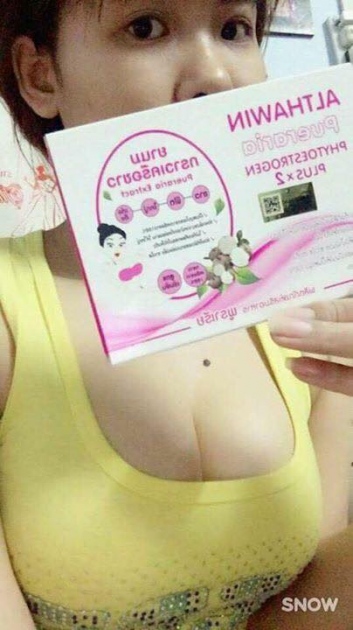 VIÊN NỞ NGỰC ANTHAWIN